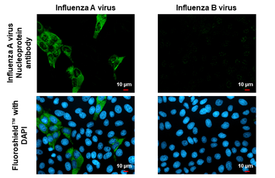 Anti-Influenza A virus Nucleoprotein antibody used in Immunocytochemistry/ Immunofluorescence (ICC/IF). GTX125989